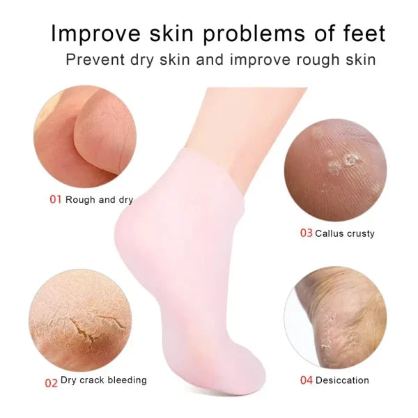 SILICONE SOCKS | MOISTURIZING JELLY SOCKS